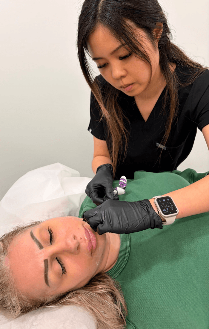 Traitement microneedling